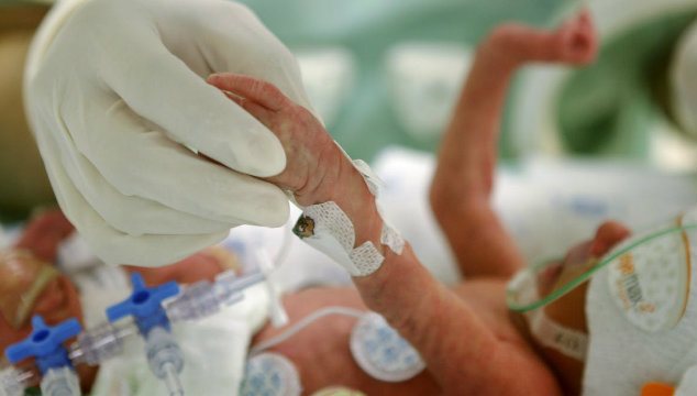 What are the Causes of Premature Birth?