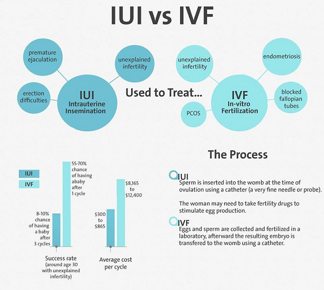 IUI and IVF compared
