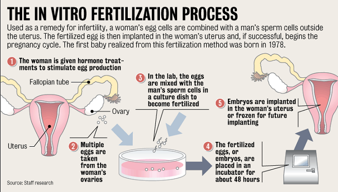 IVF procedure