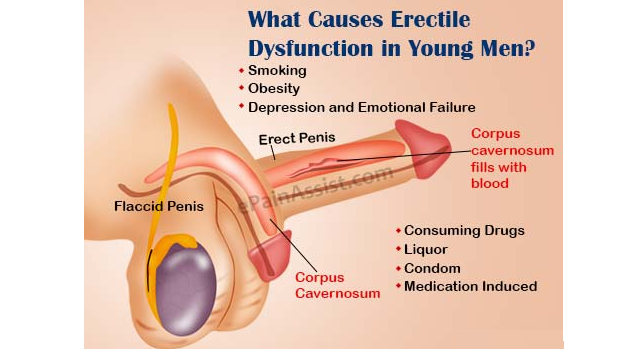 causes of erectile dysfunction