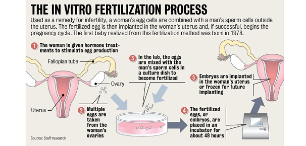 in vitro fertilization