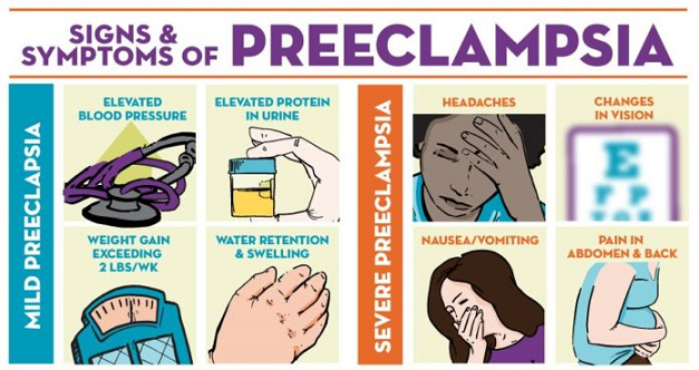 preeclampsia - one of the risks when pregnant with twins