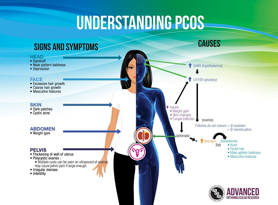 understanding PCOS