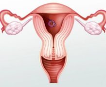 Can I Get Pregnant With Reproductive Tract Defects?
