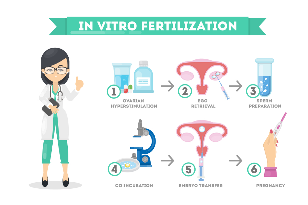 IVF